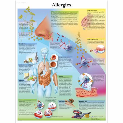 Allergies Chart, 4006715 [VR1660UU], 천식 및 알레르기 교육