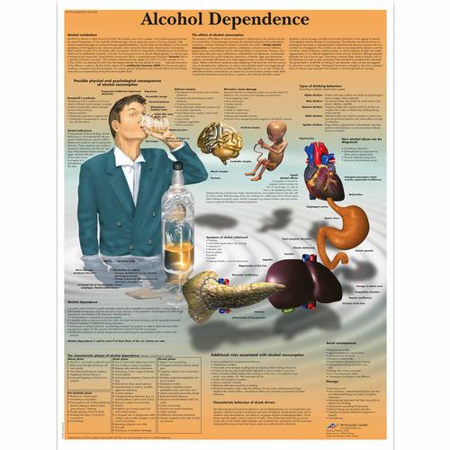 Alcohol Dependence Chart, 4006727 [VR1792UU], 약물 및 알코올 중독 교육