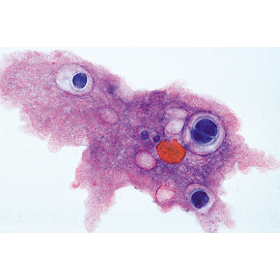 Protozoa - French Slides, 1003848 [W13001F], 현미경 슬라이드 LIEDER
