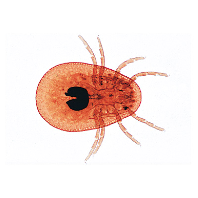 Arachnoidea and Myriapoda - German Slides, 1003863 [W13005], 현미경 슬라이드 LIEDER