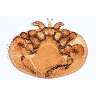 Arachnoidea and Myriapoda - German Slides, 1003863 [W13005], 현미경 슬라이드 LIEDER