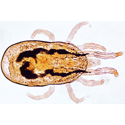 Arachnoidea and Myriapoda - Spanish, 1003866 [W13005S], 현미경 슬라이드 LIEDER