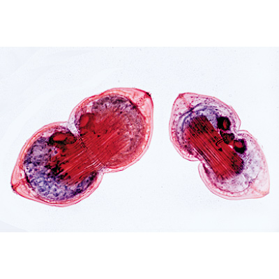 Mollusca - French, 1003872 [W13007F], 현미경 슬라이드 LIEDER