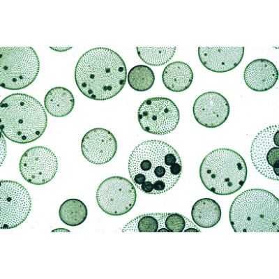 Algae - English Slides, 1003970 [W13041], 현미경 슬라이드 LIEDER