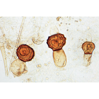 Fungi and Lichen - English Slides, 1003971 [W13042], 현미경 슬라이드 LIEDER