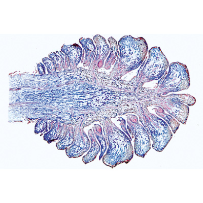 Angiospermae I. Gymnospermae - English Slides, 1003974 [W13045], 현미경 슬라이드 LIEDER