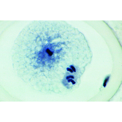 Mitosis and Meiosis Set I -German, 1013466 [W13076], 식물 세포