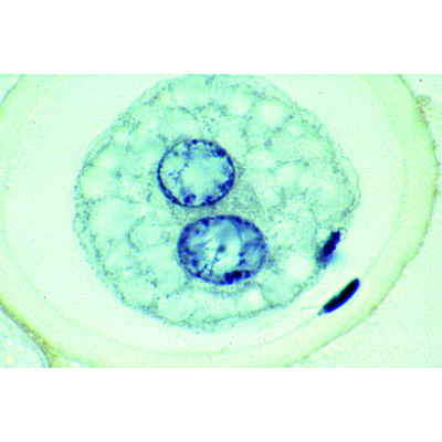 The Ascaris megalocephala Embryology, 1013479 [W13458], 세포 분열