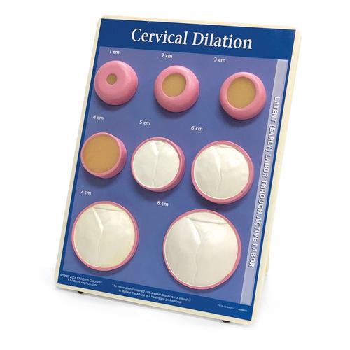 Cervical Dilation Easel Display, 1012488 [W43093], 임신 및 출산 교육