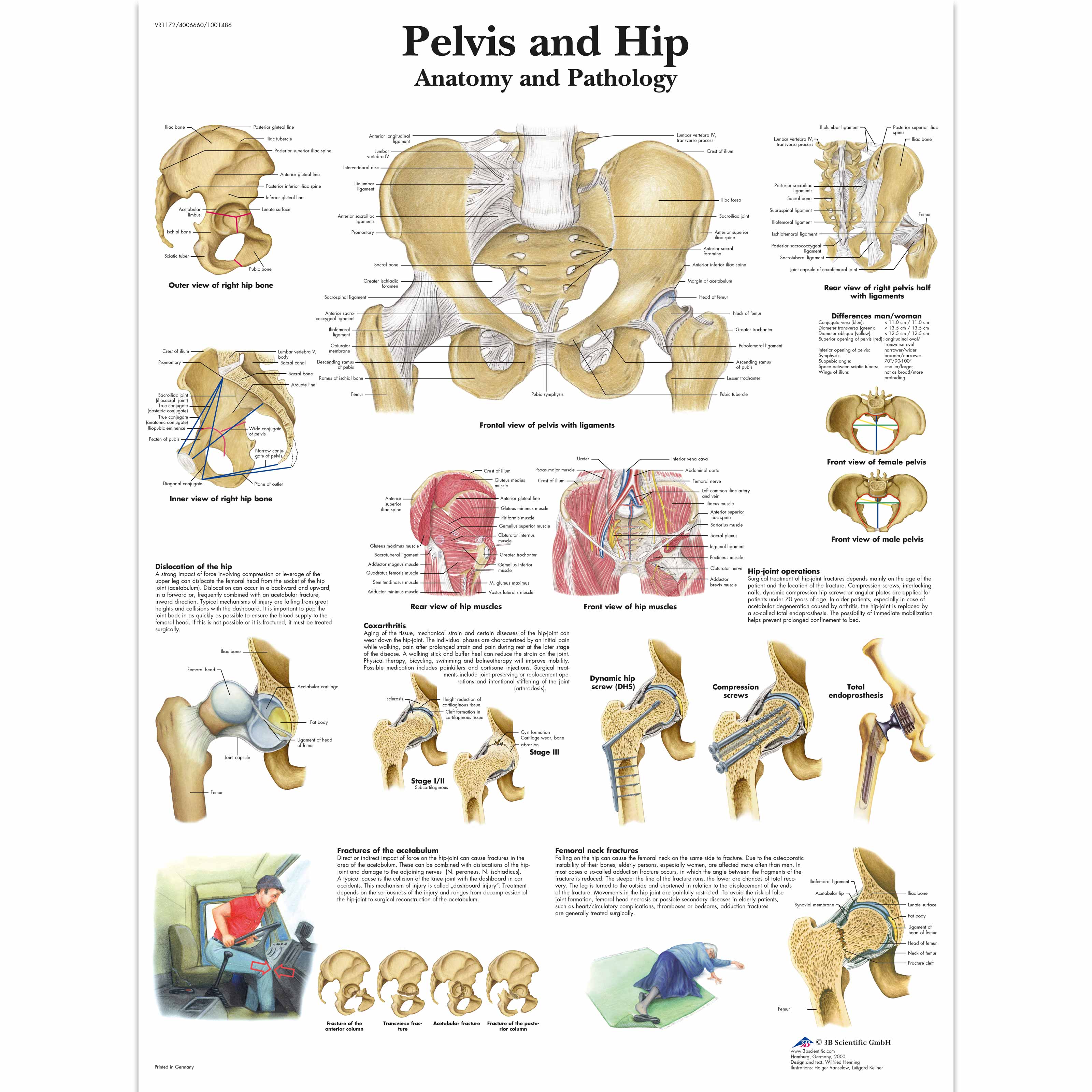 Pelvis and Hip Chart - Anatomy and Pathology - 4006660 - VR1172UU - 골격계