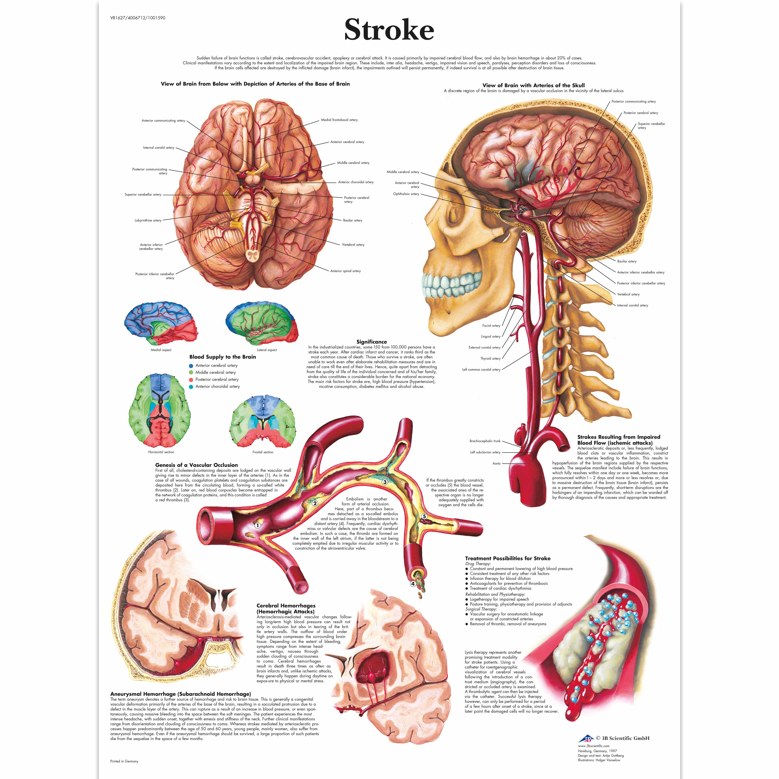 Anatomical Charts - Neurological Posters - Pathology Posters