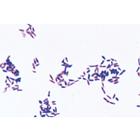 Pathogenic Bacteria - Portuguese Slides, 1004148 [W13324P], 포르투갈어
