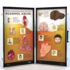 Alcohol Abuse Consequences 3-D Display, 1005582 [W43053], 약물 및 알코올 중독 교육